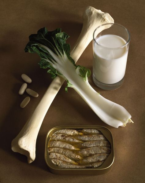 Which type of calcium supplement is best for bone health and bone healing? Calcium supplements can come as calcium carbonate, calcium citrate, and more. Foods High In Calcium, Bone Healing, Calcium Deficiency, Increase Bone Density, Calcium Citrate, Coconut Benefits, Calcium Rich Foods, Calcium Supplements, Sources Of Calcium