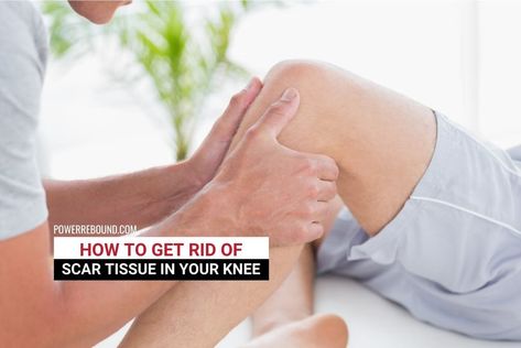 Scar Tissue Massage, Knee Replacement Surgery Recovery, Knee Replacement Exercises, Knee Replacement Recovery, Knee Surgery Recovery, Knee Operation, Getting Rid Of Scars, Preparing For Surgery, Knee Strengthening Exercises