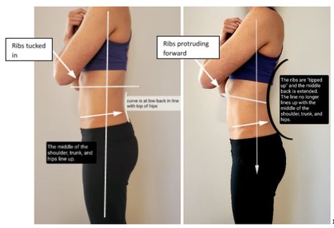 Postpartum Rib Flare, Rib Flare Correction, Exercises For Rib Flare, Flared Rib Cage, Flared Ribs Before And After, Rib Flare Before And After, Rib Flare Exercises, Flared Ribs, Better Posture Exercises