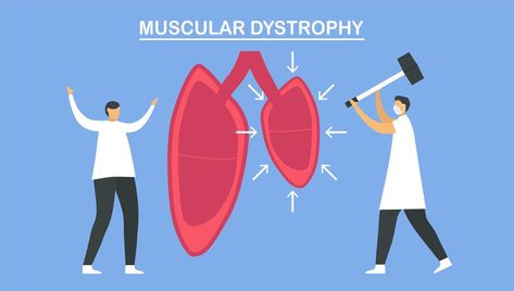 Muscular dystrophy is diseases Duchenne Muscular Dystrophy, Muscular Dystrophy, Art Room, Disease, Vector Art, For Free, Clip Art, Art