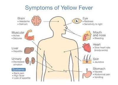 Ms Symptoms, Nerve Fiber, Stiff Neck, Yellow Fever, Muscle Weakness, Nerve Damage, Neurological Disorders, Central Nervous System, Nerve Pain