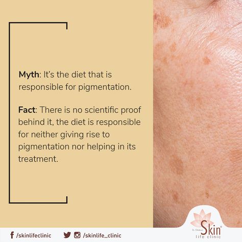 A common cause of pigmentation is an excess production of melanin. Melanin gives skin its color and doesn't have any connection with diet. #SkinPigmentation #Myths #Facts #SkinCare Skin Myths, Skin Care Myths, Skin Pigmentation, Skin Care, Diet, Skin, Quick Saves, Color