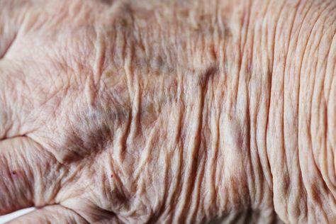 Wrinkles Photography, Grandma Painting, Wrinkles Art, Human Skin Texture, Skin Photography, Skin Folds, Wrinkles Hands, Old Skin, Skin Dress