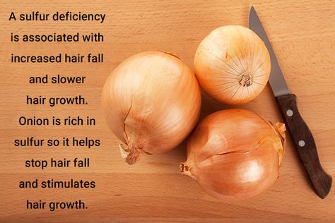 significance of onions in hair growth and repair Garlic For Hair Growth, Olive Oil For Hair, Slow Hair Growth, Olive Oil Hair, Garlic Benefits, Androgenetic Alopecia, Garlic Olive Oil, Oil For Hair, For Hair Growth