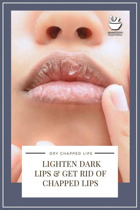 Do you have dark lips and want to achieve a pinker, more youthful look? In this video, we'll share natural remedies that can help lighten your lips and make ... Lighten Your Lips, Sugar Lip Scrub Diy, Get Pink Lips, Chapped Lips Remedy, Lighten Dark Lips, Natural Lip Scrub, Lip Lightening, Lip Scrub Recipe, Exfoliating Lip Scrub