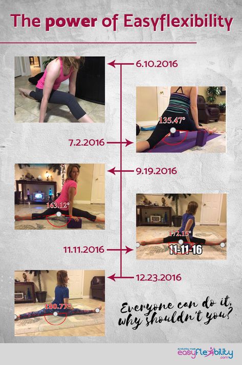 #split #splits #progress #flexibility #flexible #before #after #beforeafter #strong #easyflexibility #kinesiological #stretching Relaxing Yoga Poses, Yoga Goals, Yoga Progress, Ashtanga Vinyasa Yoga, Hip Problems, Ballet Exercises, Gentle Yoga, Relaxing Yoga, Bodyweight Workout Beginner