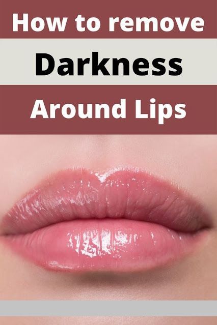 Darkness Around Lips, Darkness Around Mouth, Remedies For Dark Lips, For Dark Lips, Pink Lip Balm, Health Signs, Creating A Newsletter, Preventative Health, Health Planner