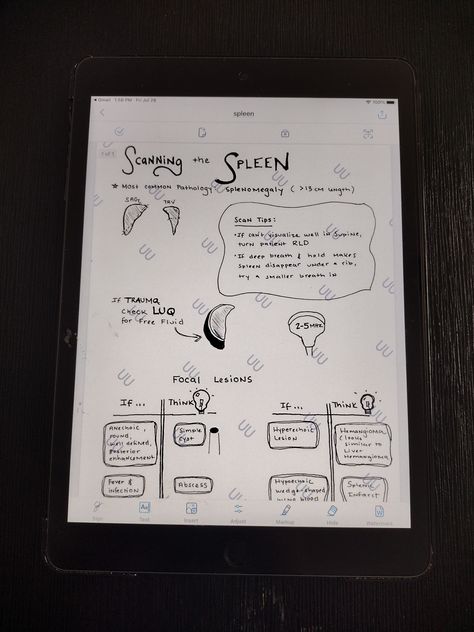 Handwritten Abdomen Scanning Cheat Sheets:  The Spleen Who This is For: Sonography Students, Sonographers/Ultrasound Techs, anyone studying for the ARDMS Abdomen Registry Exam, ARRT, or anyone wanting to understand more about Abdomen Ultrasound. Number of pages: 1 Visual notes to supplement your learning.   Covers normal, anatomical variants, and most likely pathology you will encounter when scanning, as well as scanning tips, and visual illustrations to help your brain remember!  This is a PDF Ultrasound Tech Notes, Sonography Notes, Sonography Student Study, Ultrasound Technician School, Abdomen Ultrasound, Diagnostic Medical Sonography Student, Ultrasound School, Sonography Student, Ultrasound Sonography