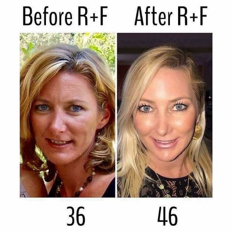 Reverse Aging Skin, Rodan And Fields Redefine, Rodan And Fields Consultant, Skin Tightening Face, Aging Backwards, Reverse Aging, Lash Boost, Life Changing Skincare, All Natural Skin Care