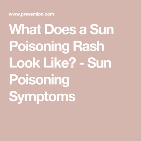 What Does a Sun Poisoning Rash Look Like? - Sun Poisoning Symptoms Sun Poisoning Rash, Sun Poisoning, Poisoning Symptoms, What To Use, To Tell, Health And Wellness, Skin Care, Sun, Health