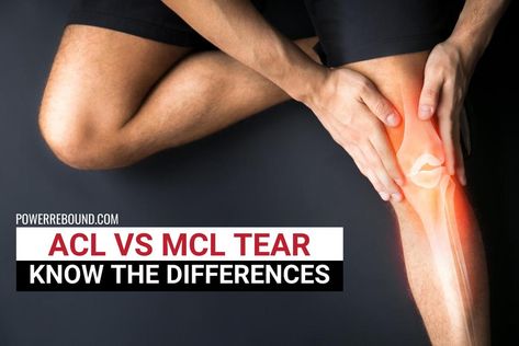 ACL vs MCL Tear: Know the Differences Mcl Injury, Bad Knee Workout, Fascia Lata, Hip Fracture, Middle Back Pain, Acl Tear, Knee Replacement Surgery, Stomach Ulcers, Best Cardio Workout