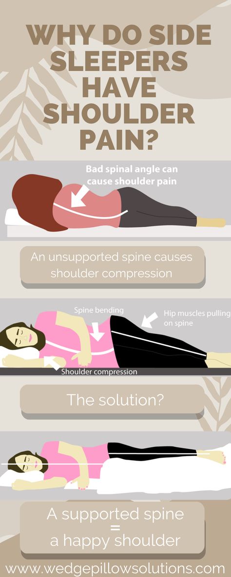 Why do side sleepers have shoulder pain Best Position To Sleep, Sleep On Left Side, Sore Neck And Shoulders, Rotator Cuff Surgery, Sleeping Pose, Sore Shoulder, Learn Yoga Poses, Sore Neck, Shoulder Pain Relief