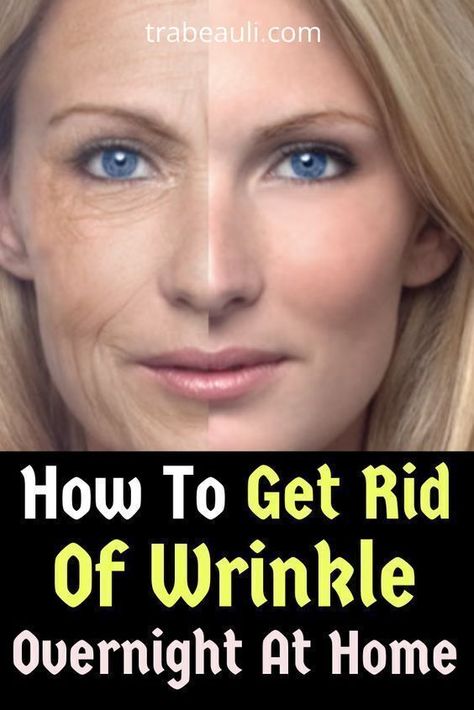 Remove Acne and Dark Spots | Beauty Tips | Prevent Wrinkles | Dry Skin | Oily SkinCare | SkinCare Routine | Skincare for wrinkles | Skin care for dark spots Skin Care For Dark Spots, Skincare For Wrinkles, Wrinkles Remedies, Wrinkles Remedies Face, Home Remedies For Wrinkles, Anti Wrinkle Mask, Glow Skincare, Oily Skincare, Wrinkle Remedies