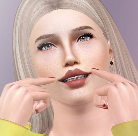 Eris Sims 3 CC Finds (descargassims:   Teeth with braces  Female and...)