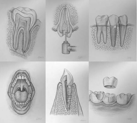 Dentist Art, Teeth Drawing, Dental Technician, Best Pencil, Dental Art, Small Canvas Art, Small Canvas, Fashion Design Sketches, Pictures To Draw