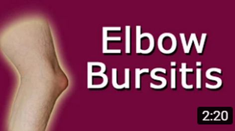 Elbow Bursitis Elbow Bursitis, Bursitis Elbow, Elbow Pain Relief, Elbow Pain, Strep Throat, Books On Amazon, Sciatic Nerve Pain, Healthy Juice Recipes, Sciatic Nerve