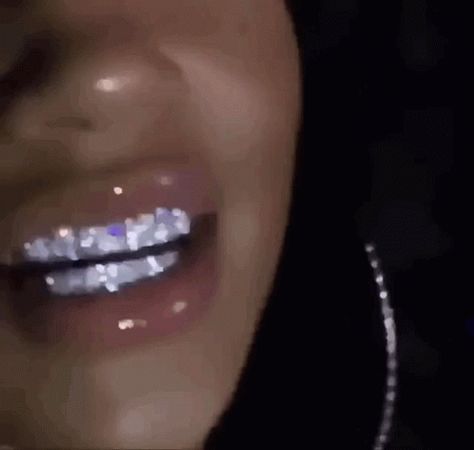 Girls With Grills, Girl Grillz, Pretty Teeth, Grillz Teeth, Diamond Grillz, Diamond Teeth, Icy Girl, Glamouröse Outfits, Grills Teeth