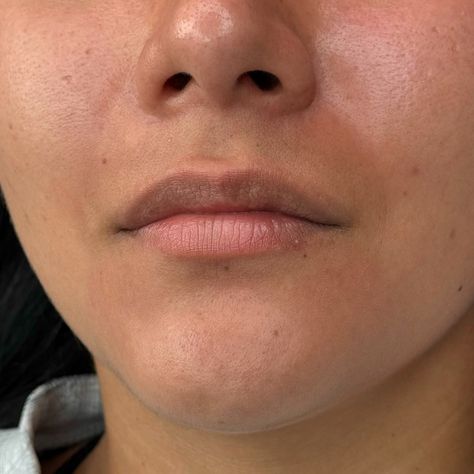 1.5 mil done on my beautiful client 💉 Defined Cupid bow Evened out top & bottom lip Now booking for December Send me a message at @Daffylavish or book through our link daffylavish.booksy.com #lipfiller #needleless #needlelessfiller #needlelesslipfiller #commerce #losangeles #boyleheights #eastlosangeles #bomblips #beforeandafter #losangeles #cityofcommerce #eastlosangeles #cityofangels #naturallook #naturalbeauty Cupid Bow, Boyle Heights, East Los Angeles, Bottom Lip, Cupids Bow, Now Booking, Lip Fillers, City Of Angels, Lips