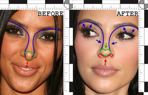 Kim Kardashian Nose, Kardashian Plastic Surgery, Plastic Surgery Facts, Kim Kardashian Before, Job Photo, Bulbous Nose, Rhinoplasty Nose Jobs, Botox Before And After, Hair Implants