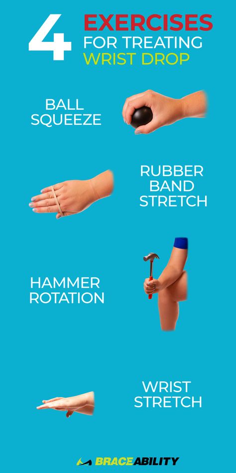 Are you looking to treat Wrist Drop? Wrist drop is a condition that typically accompanies Radial Nerve Palsy. If you are suffering from wrist drop, you will be unable to extend your fingers and wrist. You will have no control over your wrist or fingers. The main cause of wrist drop is overuse of the wrist and hands. This condition is commonly seen in athletes who play sports like tennis or badminton. Check out these exercises to help treat your Wrist Drop. Wrist Drop Exercises, Radial Nerve Exercises, Wrist Exercises Strength, Humerus Bone, Hand Therapy Exercises, Nerve Injury, Wrist Stretches, Radial Nerve, Infant Lesson Plans