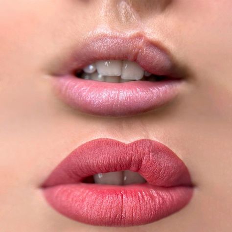 Cleft Lip Scar, Cleft Lip Tattoo Ideas, Lipstick For Dark Lips, Lip Hyperpigmentation, Cosmetic Lip Tattoo, Lip Tattoo Ideas, Lip Print Tattoos, Lip Color Tattoo, Blush Lips