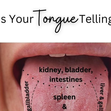 Kale Blossom | Drs. Carly & Rachel | Holistic Health on Instagram: "Our bodies give us great clues… if we pay attention. 😉

In traditional Chinese medicine, tongue analysis is often used because it is believed that the tongue holds clues as to the health of the ENTIRE body. How cool is that?! 

The most common is typically a large crack down the middle of the tongue— possibly indicating poor digestion. 💩

Another is scalloped edges on both sides of your tongue— which may indicate adrenal dysfunction. 🫣

Have you ever looked at your tongue? Or had your tongue evaluated? 

If you’re experiencing any health struggles or symptoms, take a peek at your tongue & see what it’s telling you. 💗
•
•
•
#bodywisdom #cluestobodyhealth #wholehealth #naturalmedicines #womenshealthmatters #traditionalch Cracked Tongue, Adrenal Dysfunction, Body Wisdom, Poor Digestion, Tongue Health, Traditional Chinese Medicine, Health Matters, Chinese Medicine, Scalloped Edges