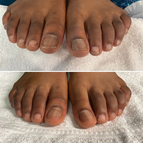 Pedicure For Men, Men Pedicure, Mens Manicure, Pedicure Designs Toenails, Pedicure Designs, Black Men Fashion, Manicure Pedicure, Manicure And Pedicure, Toe Nails