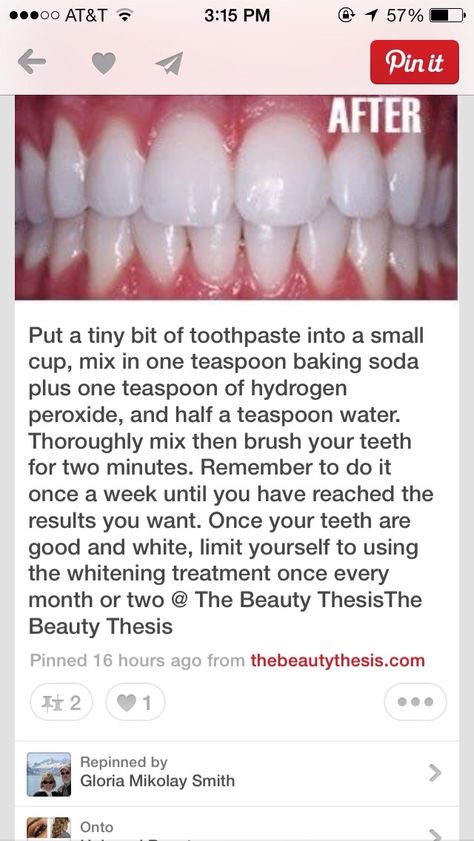 How To Get White Teeth Fast - Easy -STRONG Get Whiter Teeth, Teeth Whitening Remedies, Teeth Whitening Diy, Skin Care Routine For 20s, Stronger Teeth, Best Teeth Whitening, Oral Care Routine, Receding Gums, Natural Teeth Whitening