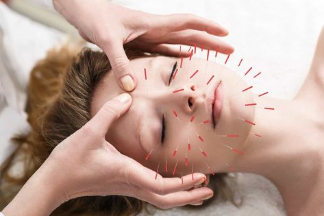 Summer Allergies, Seasonal Allergy Symptoms, Acupuncture Clinic, Chinese Herbs, Botox Injections, Allergy Relief, Tension Headache, Acupuncture Points, Menstrual Cramps