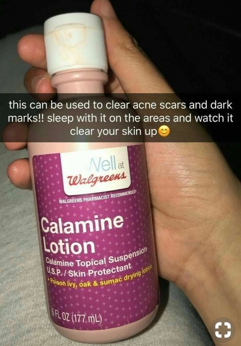 Calamine lotion for acne scars and dark marks Calamine Lotion For Acne, Shaving Hacks, Acne Scaring, Acne Lotion, Calamine Lotion, Acne Scar Removal, Clear Skin Tips, Beauty Diy, High Maintenance