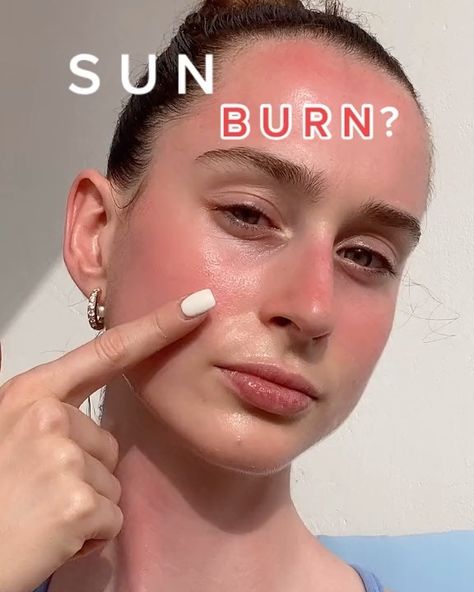 Skincare | Facemasks on Instagram: “But never forget to wear sunscreen 🧴 👉Follow @facemaskseveryday for more daily skincare tips💗 👉Follow @facemaskseveryday for more daily…” Aloe Vera Ice Cubes, Sunburn On Face, Sunburn Face, Non Toxic Skincare, Aloe Vera For Sunburn, Sunburn Skin, Sunburn Remedies, Sunburn Relief, Aloe Vera Skin Care