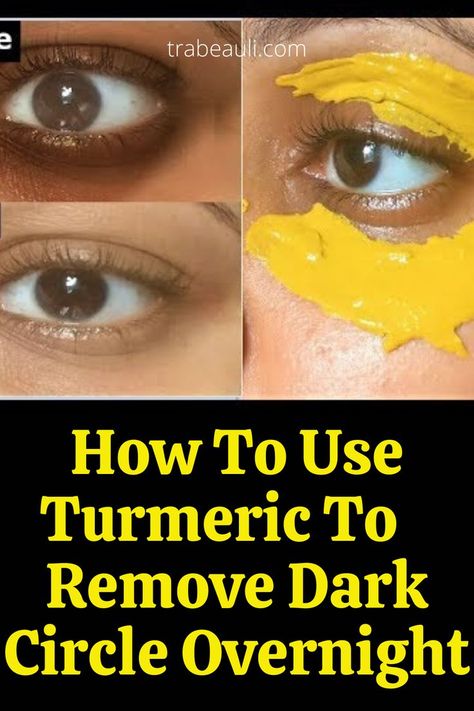 turmeric for dark circles Turmeric Skin Lightening, Turmeric Benefits For Skin, Eye Lightening, Dark Spots Under Eyes, Skin Lightening Diy, Dark Spots Remedies, Brighten Skin Naturally, Dark Circle Remedies, Lighten Skin Tone