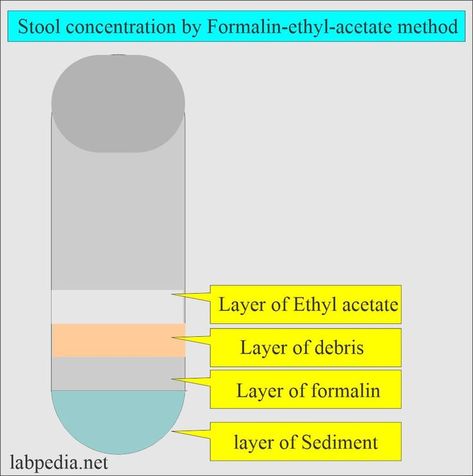 Stool Examination Sample for Stool Examination Can take a random stool sample. More than 2 grams of the stool is needed, ideally 2 to 5 grams, sometimes called a pigeon's egg. To rule out worm infestation, three consecutive stools are tested. Collect three stools in the span of 10 days. Two samples on alternate days. The hospitalized patient can take a stool sample every day. Multiple samples are needed to rule out the parasitic infestation. One samp... Clinical Laboratory, Stool Sample, White Blood, White Blood Cells, Test Tube, Stools, 10 Days, Egg, Medical