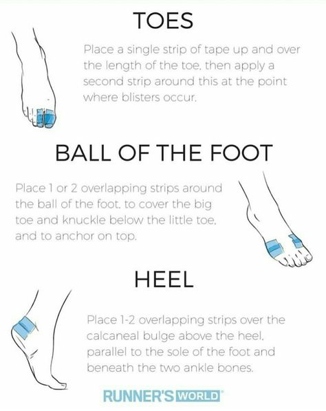 Blister prevention tips for runners Trail Running Essentials, Runners Essentials, Runner Essentials, Ballet Injuries, Start Running Beginner Runner, Running Treadmill Workout, Run Tips, Running Endurance, Half Marathon Motivation