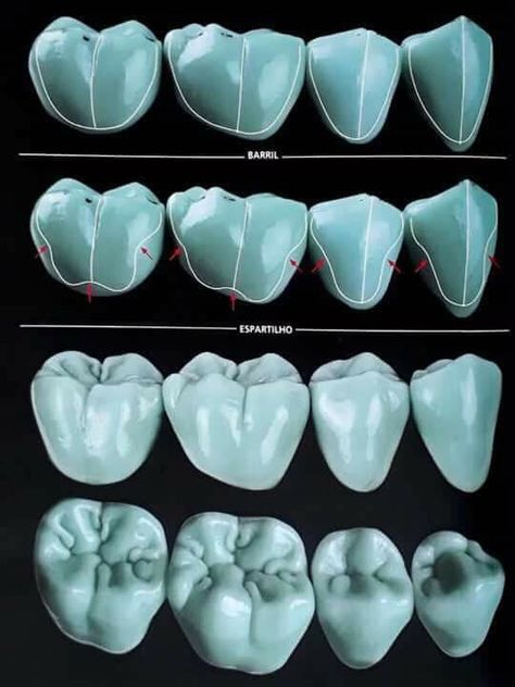 Dental Lab Technician, Dental Ceramics, Dental Pictures, Dental Images, Dental Aesthetics, Dental Restoration, Kedokteran Gigi, Dental Videos, Dental Anatomy