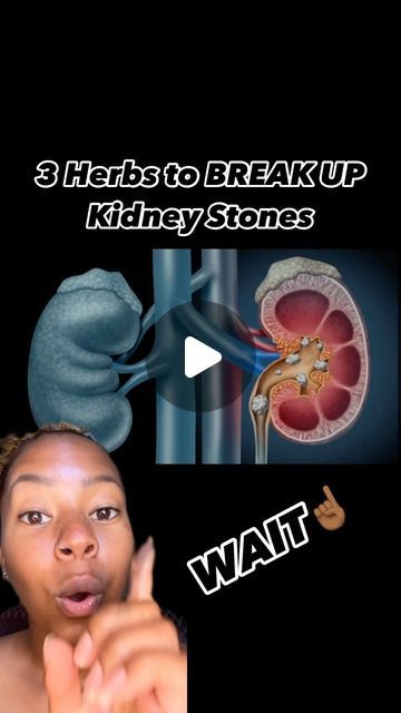 Millicent | Holistic Lifestyle| Alternative Medicine on Instagram: "3 Herbs to help BREAK UP Kidney Stones‼️
.
.
1. Chanca Peidra (Stonebreaker) 
2. Dandelion Root
3. Nettle Leaf
.
.
.
#kidney #kidneystones #health #wellness #herbs #cleanse #detox #foryou #trending #explore" Kidney Stone Herbs, Herbs To Help Kidneys, Kidney Stone Cleanse, How To Pass A Kidney Stone Fast, Kidney Stone Remedies, Kidney Stone Pain Relief, Nettle Leaf, Homeopathy Remedies, Kidney Detox