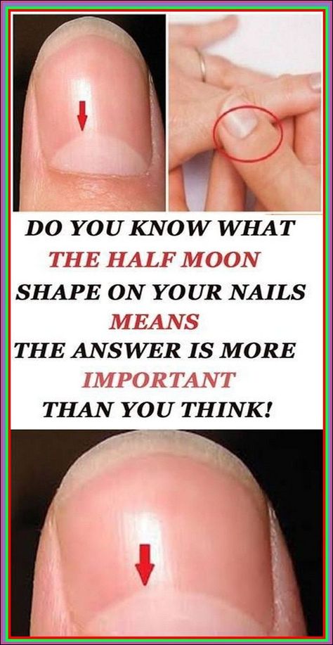 DO YOU KNOW WHAT THE HALF MOON SHAPE ON YOUR NAILS MEANS THE ANSWER IS IMPORTANT! Moon On Nails, Body Facts, Healthy Hacks, Layers Of The Epidermis, Health Topics, Awesome Photography, Urban Survival, Pallet Garden, Adorable Cats