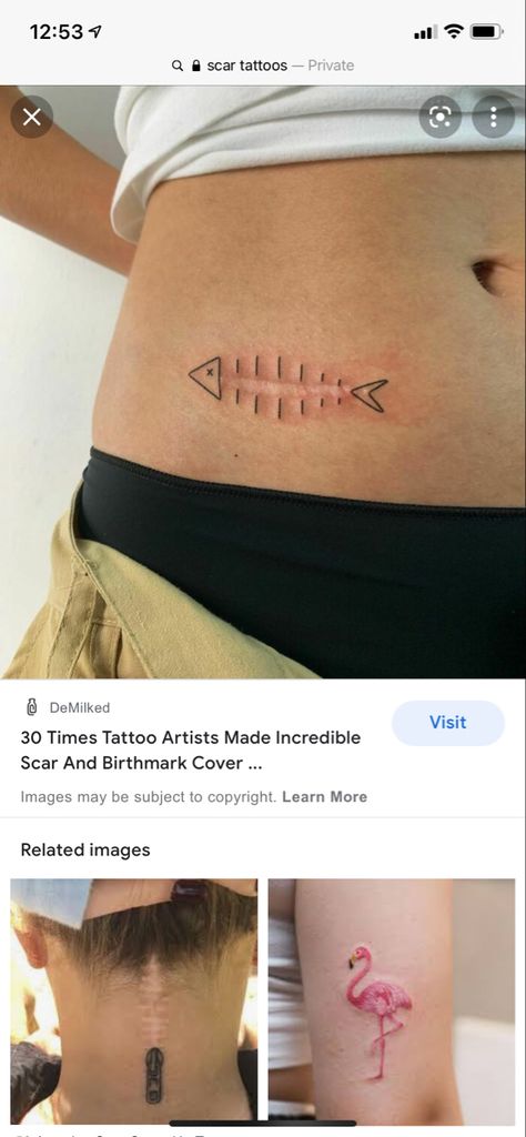 Fish Scar Tattoo, Strechmark Tatoos, Tattoo Over Strechmark, Scar Tattoo, Jesus Fish Tattoo, Tattoos For Women, Tattoo Artists, Tattoo Quotes, Tatting