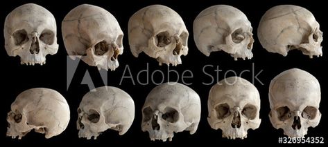 Skull No Jaw, Skull Without Jaw, Skull Painting, Low Angle, Human Skull, Pretty Pictures, Black Background, Mood Boards, Black Backgrounds