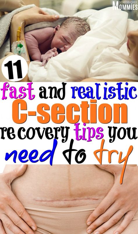 Speed up your healing with these C-section recovery tips.From a mom who has been there.Get the list of these realistic and doable C-section recovery tips! Healing From C Section, Pregnancy Second Trimester, Newborn Care Tips, Pregnancy Tips For New Moms, Birth Recovery, C Section Recovery, Cesarean Section, Bag Checklist, Hospital Bag Checklist