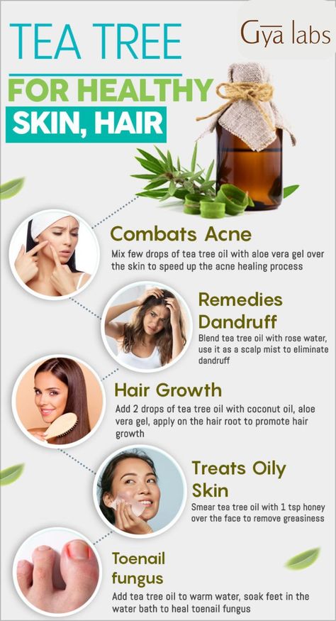 uses of tea tree essential oil Tea Tree Essential Oil Benefits, Best Tea Tree Oil, Tea Tree Oil Hair, Tea Tree Oil Uses, Tea Tree Oil For Acne, Aloe Vera Hair Mask, Natural Acne Remedies, Acne Oil, Hair Dandruff