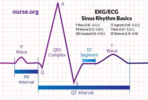 How To Read An Electrocardiogram (EKG/ECG) Ekg Interpretation Made Easy, Ekg Lead Placement Cheat Sheets, Ecg Placement, Ecg Reading, Ekg Tech, Lethal Rhythms Ekg, Ekg Electrode Placement, Ekg Rhythms, Ekg Interpretation