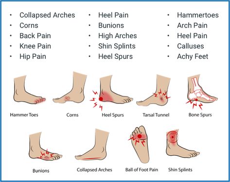 Superthotics Ucla School Of Medicine, Foot Anatomy, Yoga Information, Medical School Studying, Shin Splints, Foot Soak, Thai Massage, Medical Terms, Shoe Inserts