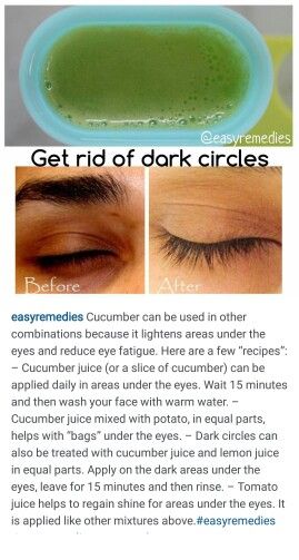 Dark Eye Circles, Remove Dark Circles, Dark Circles Under Eyes, Dark Under Eye, Dark Circle, Foreign Language, Dark Eyes, Face Scrub, Language Learning