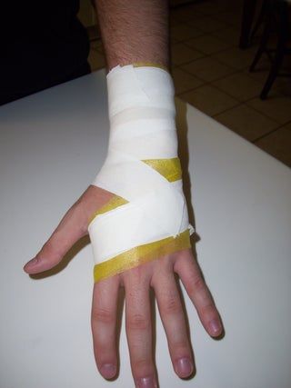 Protective Taping of the Wrist : 6 Steps - Instructables Stiches Injury, Pulling Hair Out, Medical Pictures, Design Student, Design Challenges, Body Health, Medical, Health, Quick Saves