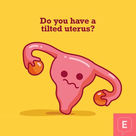 "When the technician reassured me it wasn't bad and that actually most women have a retroverted uterus, I couldn't help but wonder if maybe, just maybe my case was one of the ones causing extra discomfort and pain." Click to read more. #endometriosis #endo #womenshealth #health #uterus #endowarrior One Ovary Removed, Retroverted Uterus Exercise, Ovary Health, Tilted Uterus, Endo Pain, Endo Awareness, Retroverted Uterus, Ovary Pain, Ovulation Pain