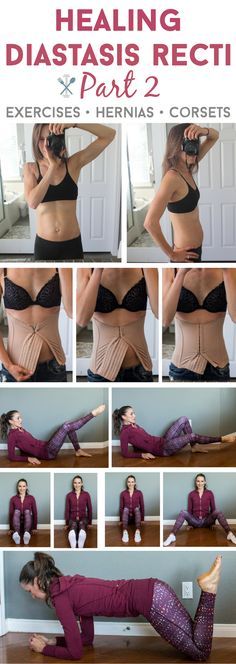 Exercises and my personal experience healing diastasis recti - proper ab work, umbilical hernias, and wearing compression corsets #sponsored Fitness Pregnancy, Diástase Abdominal, After Baby Workout, Change Motivation, Healing Diastasis Recti, Postpartum Exercise, Post Baby Workout, Diastasis Recti Exercises, Postpartum Fitness