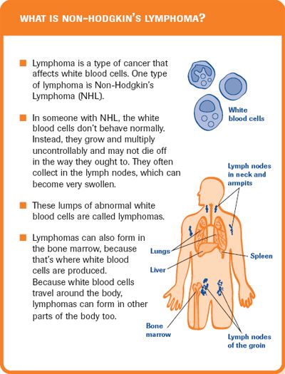 Non Hodgkins, Non Hodgkin Lymphoma, Hodgkin Lymphoma, Lymphoma Awareness, Nursing Study Guide, Medical Surgical Nursing, Oncology Nursing, Lymph Nodes, Nursing Study