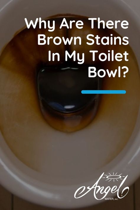 If they won’t scrub away with regular cleaning products, then contaminants in your water are to blame. And what’s frustrating is scrubbing harder often only makes these stains worse! So, what can homeowners with brown stains in their toilets do? The good news is, there are ways to get rid of these unsightly blemishes! Cleaning Toilet Stains, Toilet Bowl Stains, Toilet Cleaning Hacks, Toilet Stains, Clean Toilet Bowl, Hard Water Stains, Water Softener, Toilet Cleaning, The Good News