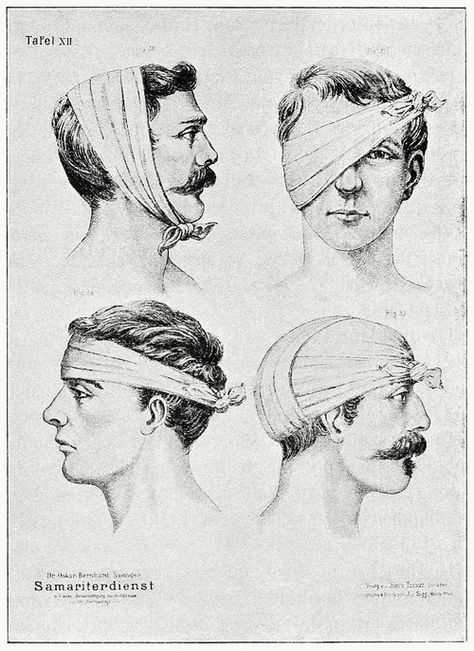 Bandages with cloths, plate XII. From... Clutching Head Reference, Wound Reference, Face Bandages, Head Bandage, Creepy Houses, Vintage Medical, Medical Aesthetic, Medical Illustration, Medical History